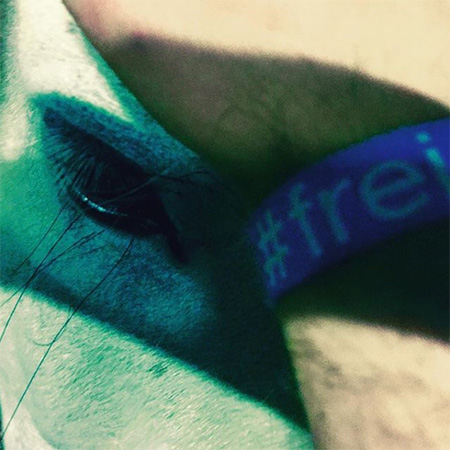 Das Foto zeigt einen Arm mit #frei Band am Handgelenk. Im Hintergrund erkennt man ein Pferdeauge.